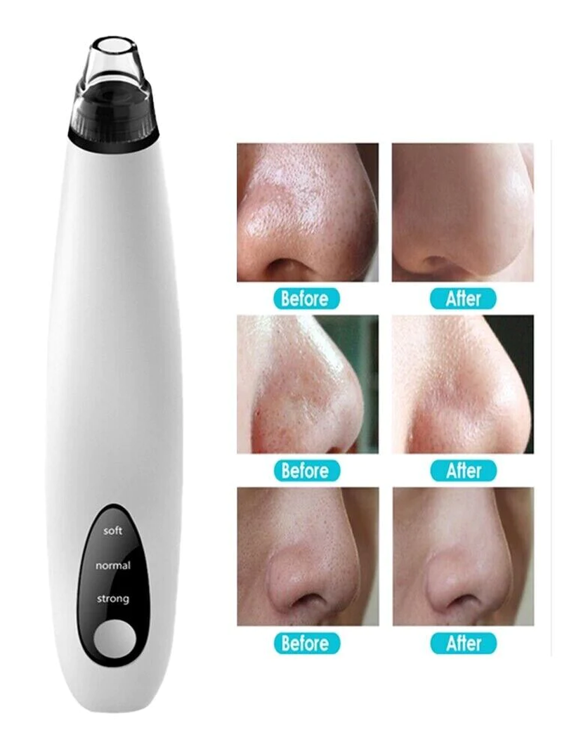 Electric blackhead remover vacuum with soft, normal, and strong suction modes showing nose before-and-after results for clearer pores and smoother skin.