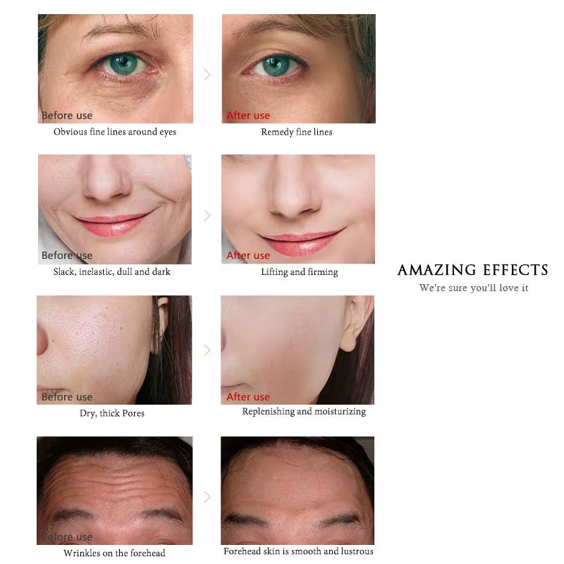 24K Gold Niacinamide Face Essence 30Ml Moisturizing Hyaluronic Acid Serum Dry Skin Care