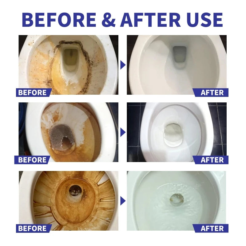 Three-row comparison of toilet bowls before and after using JAYSUING foam cleaner pods, showing heavy brown stains removed and bowls restored to clean white condition with swirling water effect.